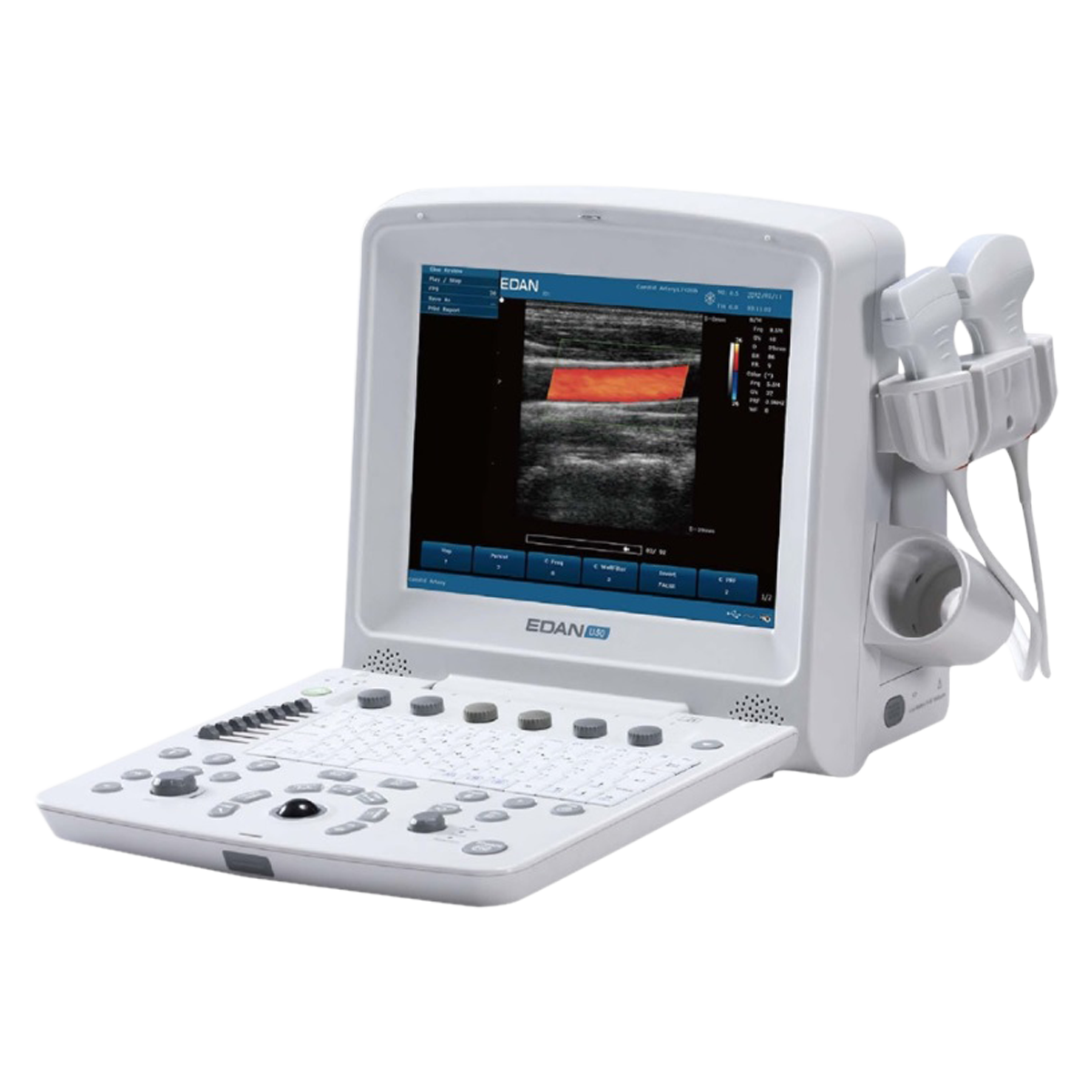 Ultrasound U50 Prime